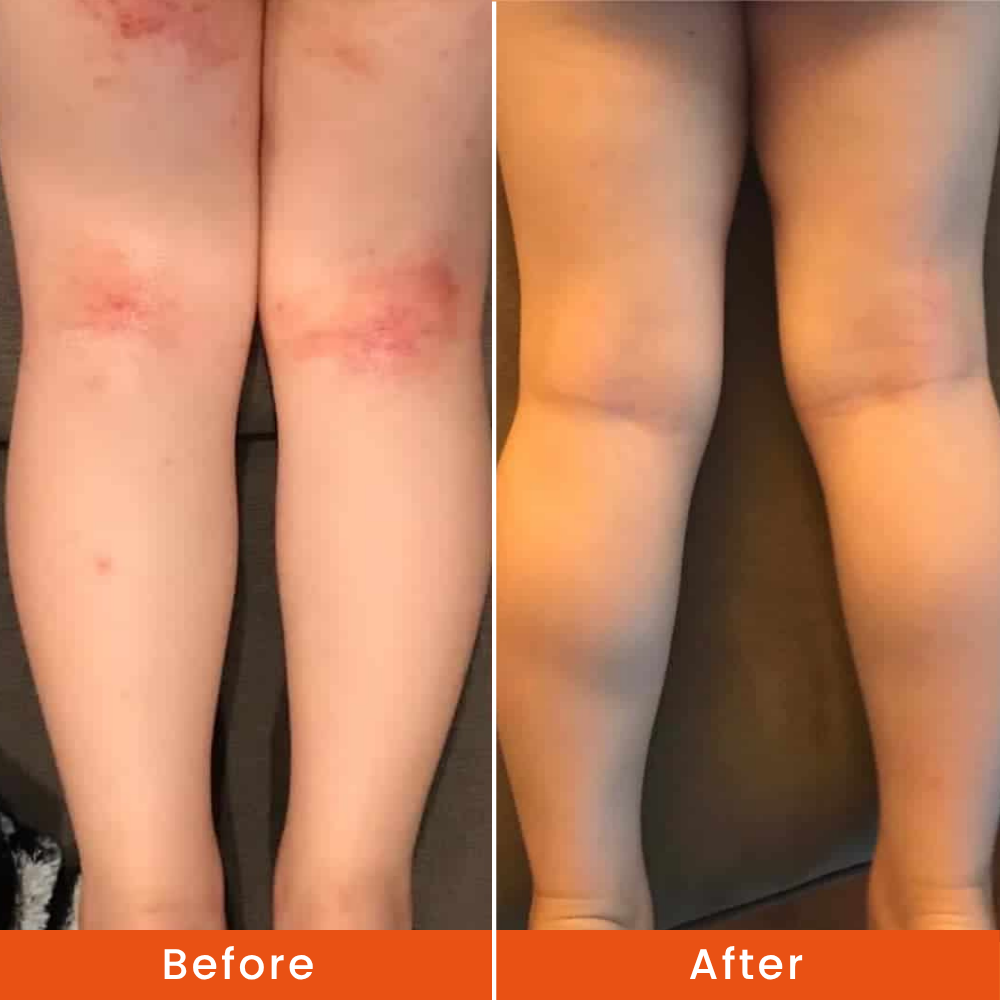 dry patches.