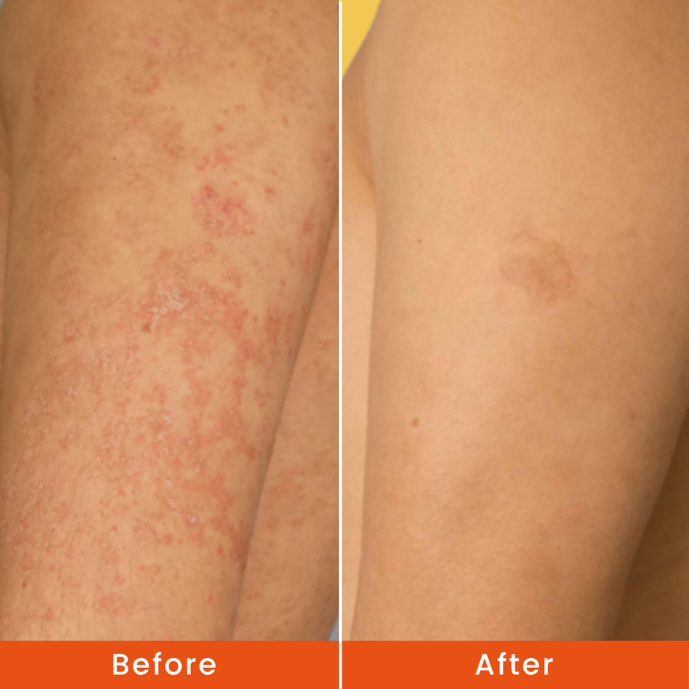 skin stopped itching